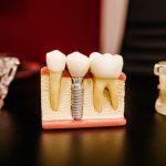 Photo dentistry