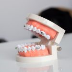 Photo dentistry