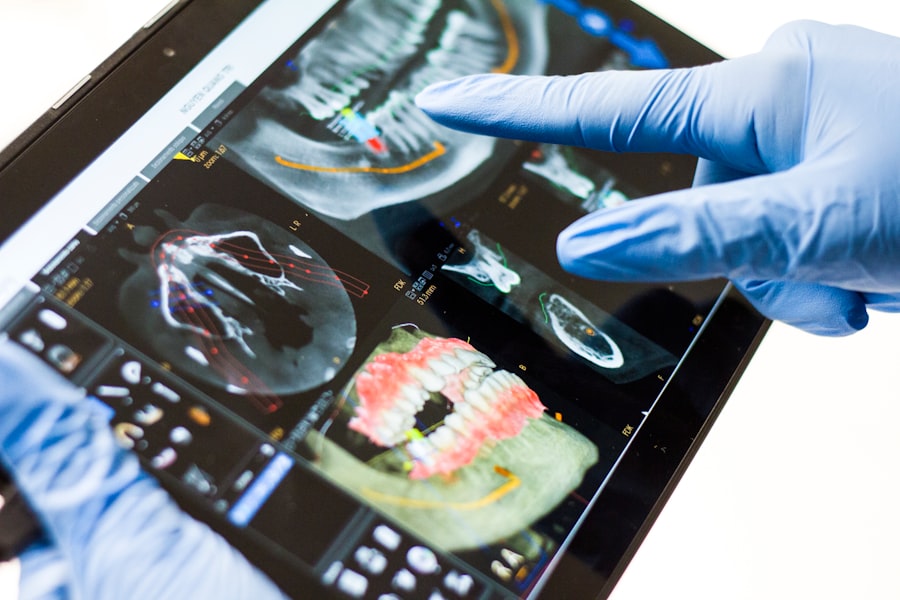 periodontal disease symptoms
