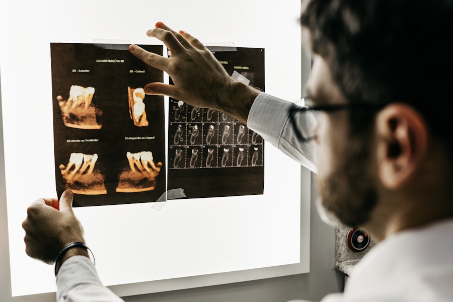 Photo periodontal disease symptoms
