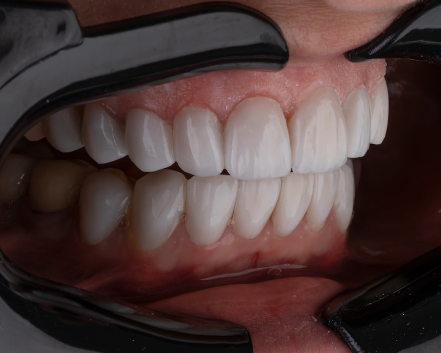 Photo oral hygiene