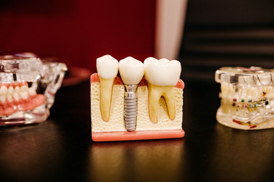 Photo braces