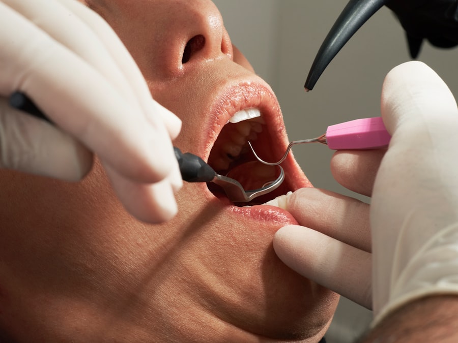 Photo dentistry discounts