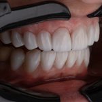 Photo dentistry