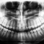 Photo stomatologie